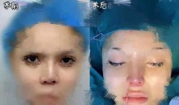 爆料整容視頻,視頻爆料引發(fā)熱議