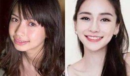 娛樂圈齙牙爆料,揭秘明星背后的秘密與爭議